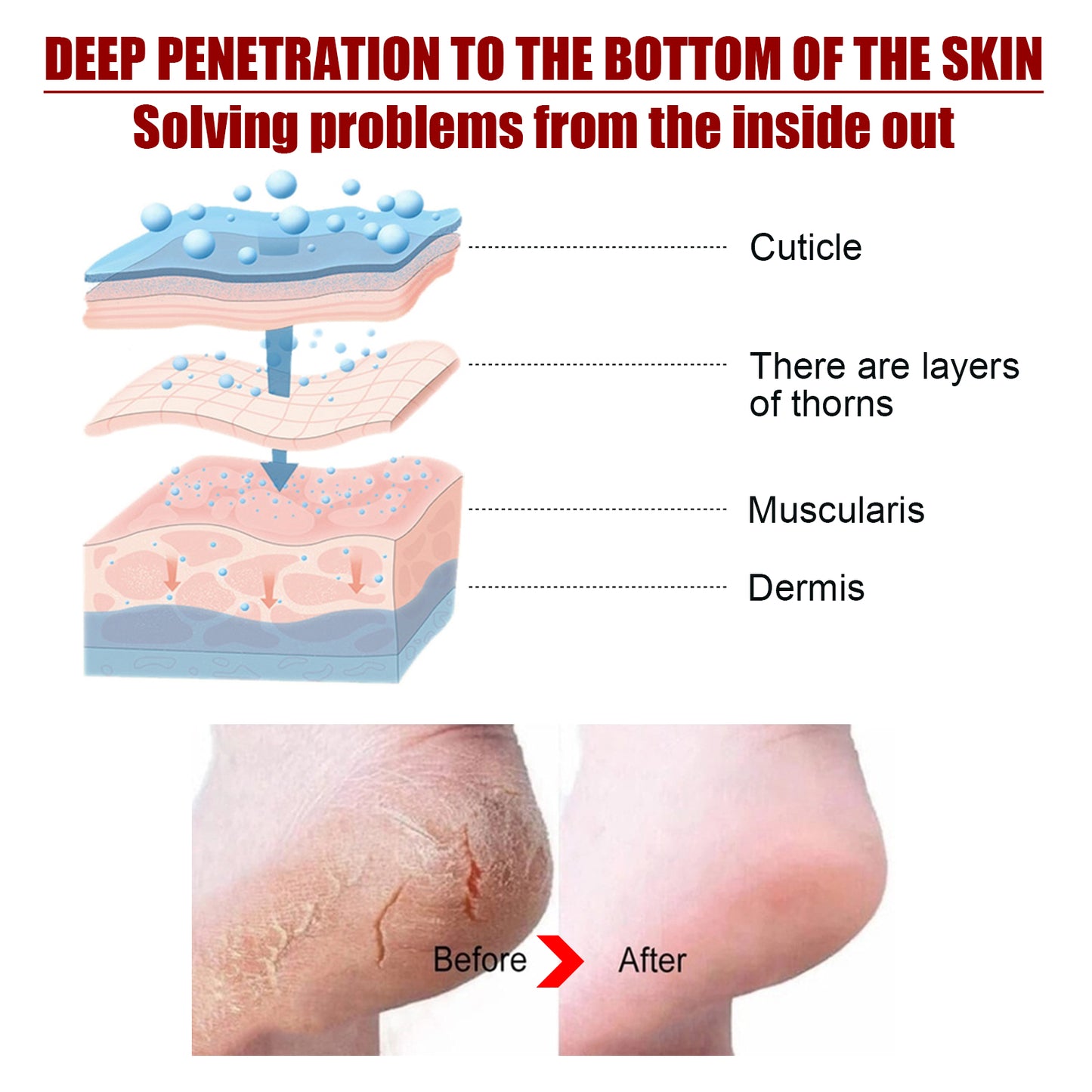 Glycolic acid foot peel, moisturizing and rejuvenating, removes calluses and dead skin, hydrates and nourishes for beautiful feet